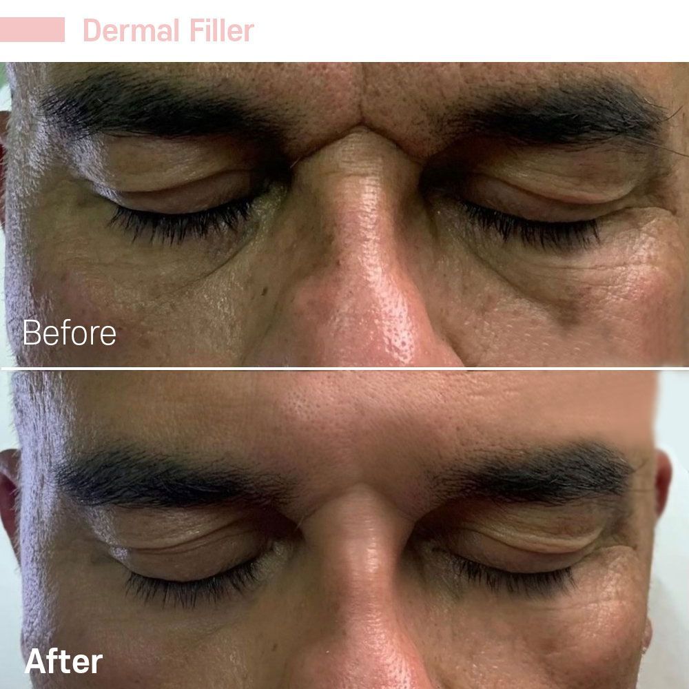 Before And After Eleven — Tustin, CA — RoseK Medical