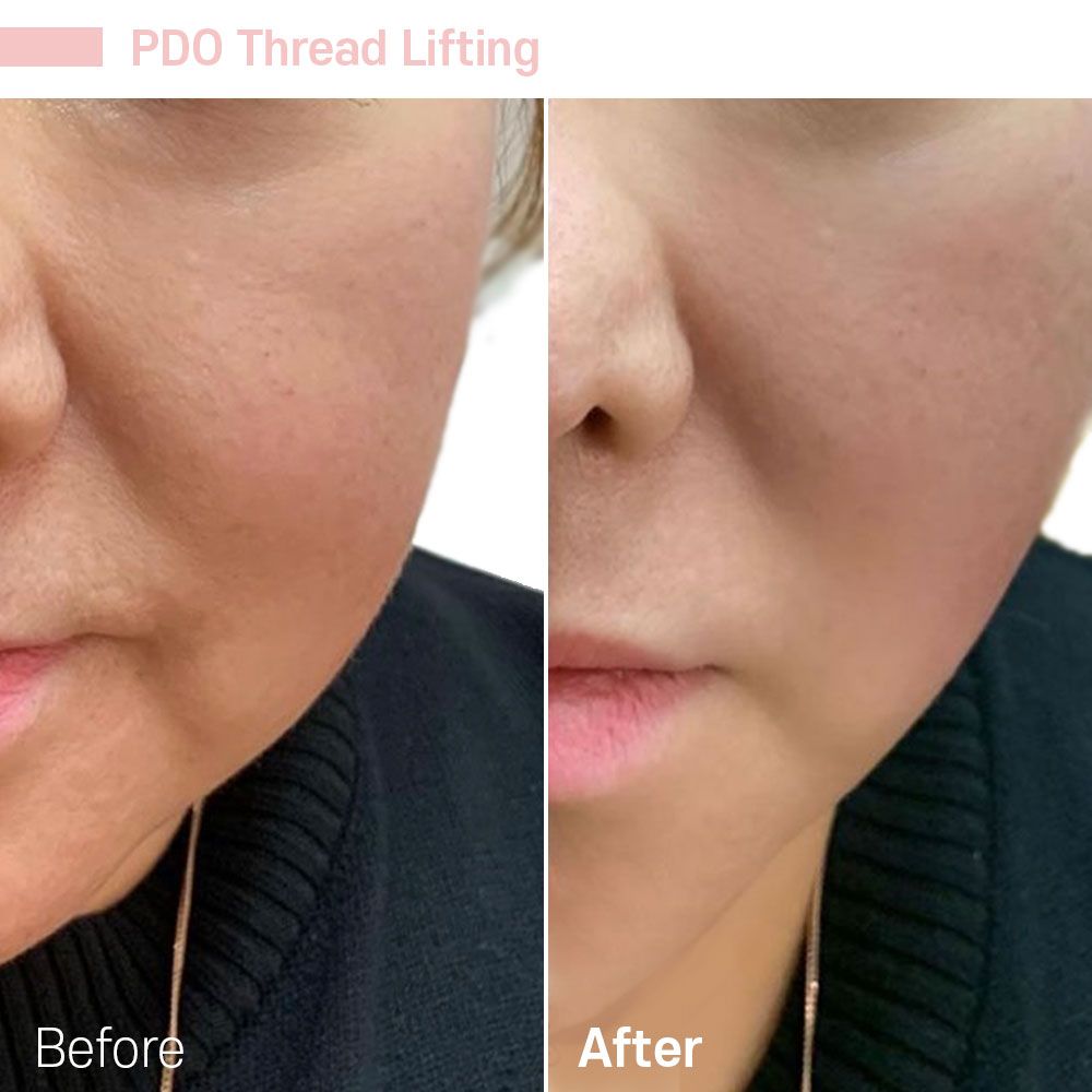Before And After Ten — Tustin, CA — RoseK Medical