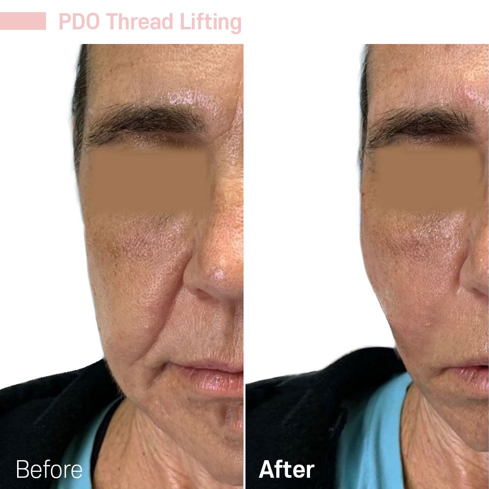 Before And After Nine — Tustin, CA — RoseK Medical