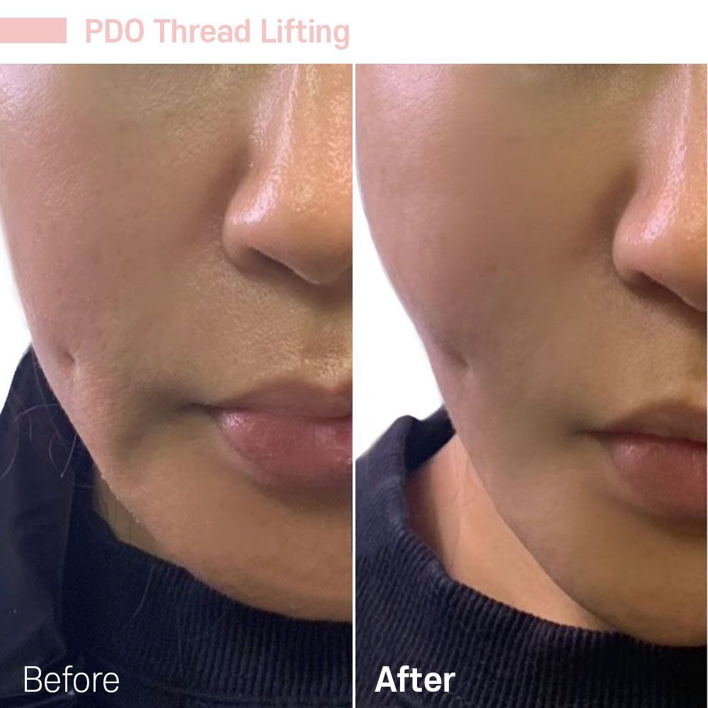 Before And After Seven — Tustin, CA — RoseK Medical