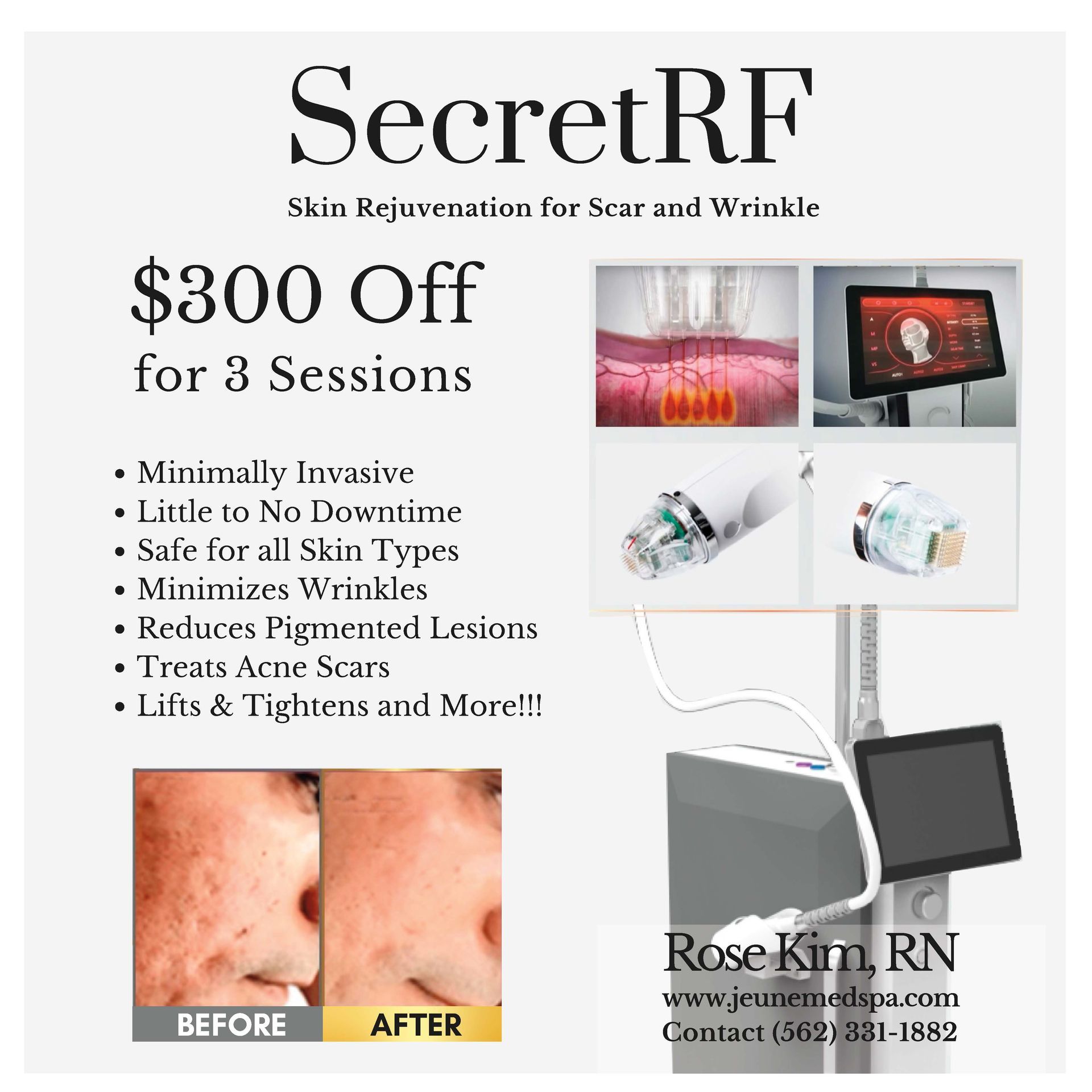 Promotion Four — Tustin, CA — RoseK Medical