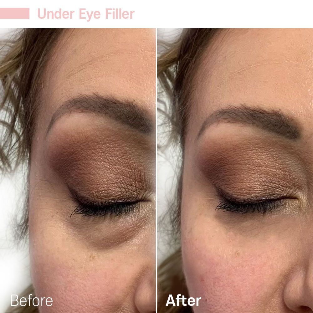 Before And After Two — Tustin, CA — RoseK Medical