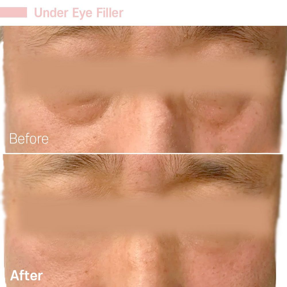 Before And After Five — Tustin, CA — RoseK Medical