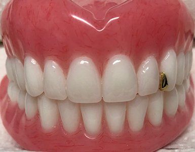Denture — Burleigh Denture Clinic in Burleigh Heads, QLD
