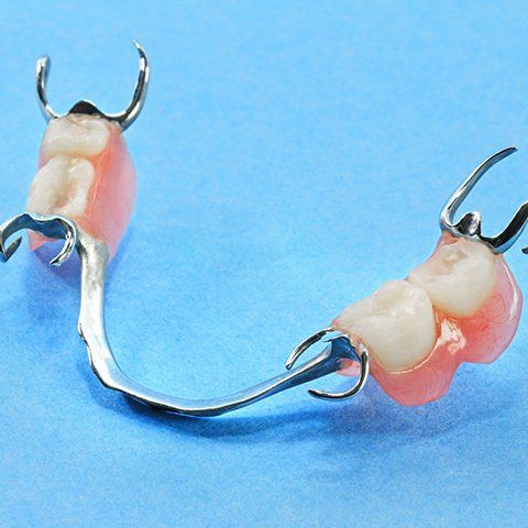 Metal Partial Dentures — Burleigh Denture Clinic in Burleigh Heads, QLD