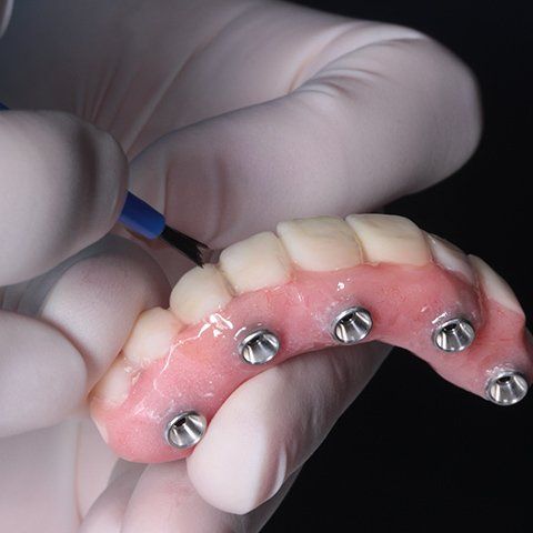 Dental Prosthetist Holding Denture — Burleigh Denture Clinic in Burleigh Heads, QLD