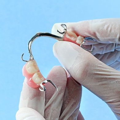 Metal Based Partial Dentures — Burleigh Denture Clinic in Burleigh Heads, QLD