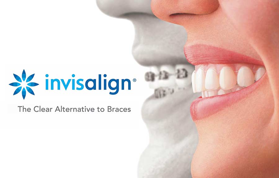 Logo Invisalign