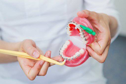 Prova apparecchio su modello