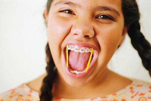 Apparecchio per denti