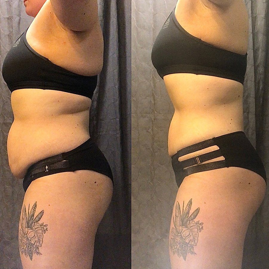 Michie client transformation