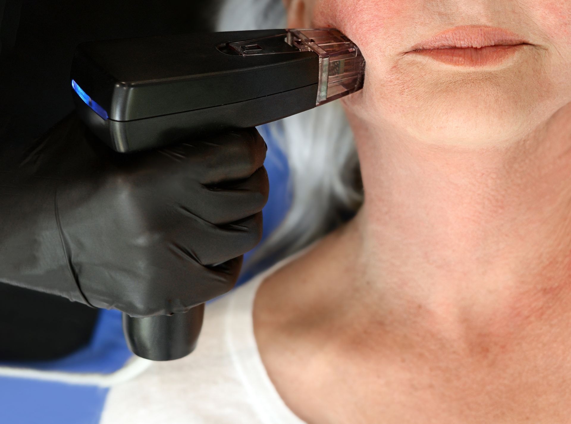 A woman is getting a laser treatment on her face.