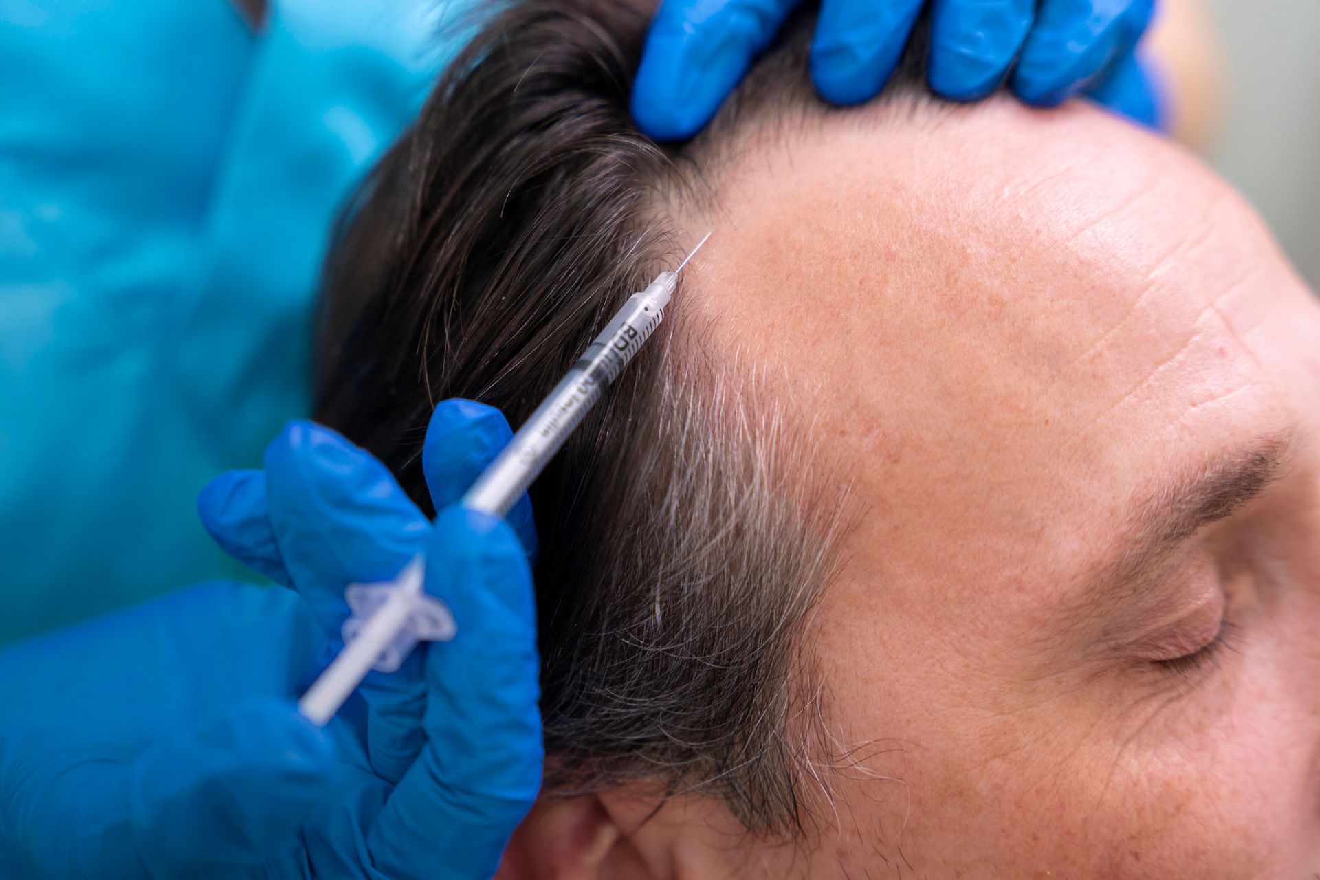 A man is getting an injection in his head with a syringe.