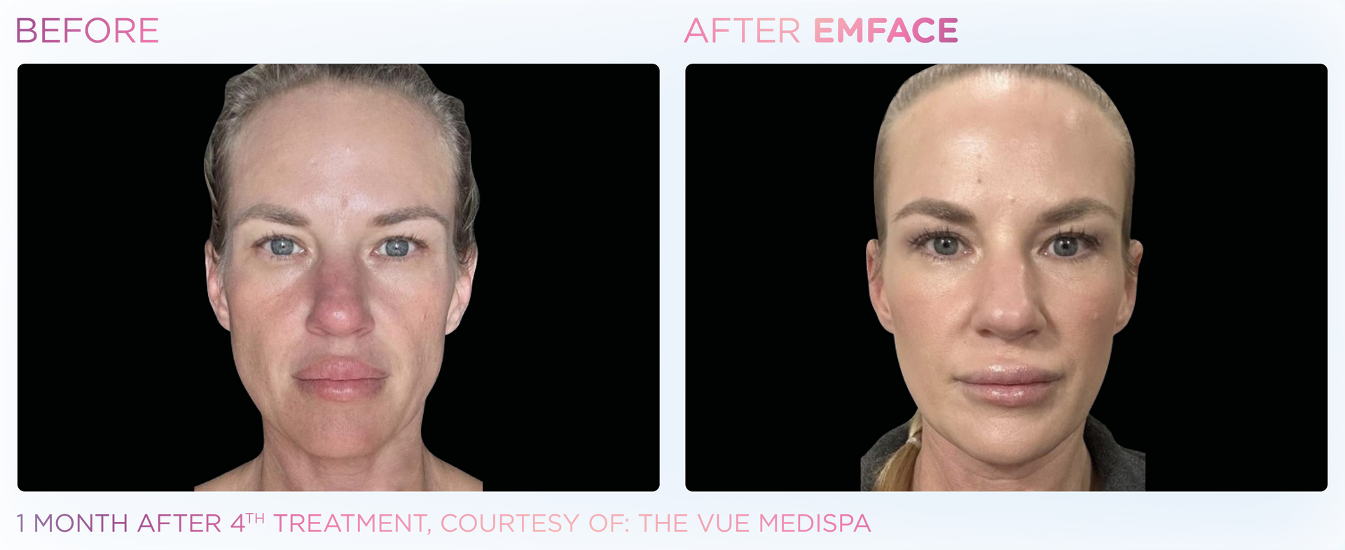 A before and after photo of a woman 's face.