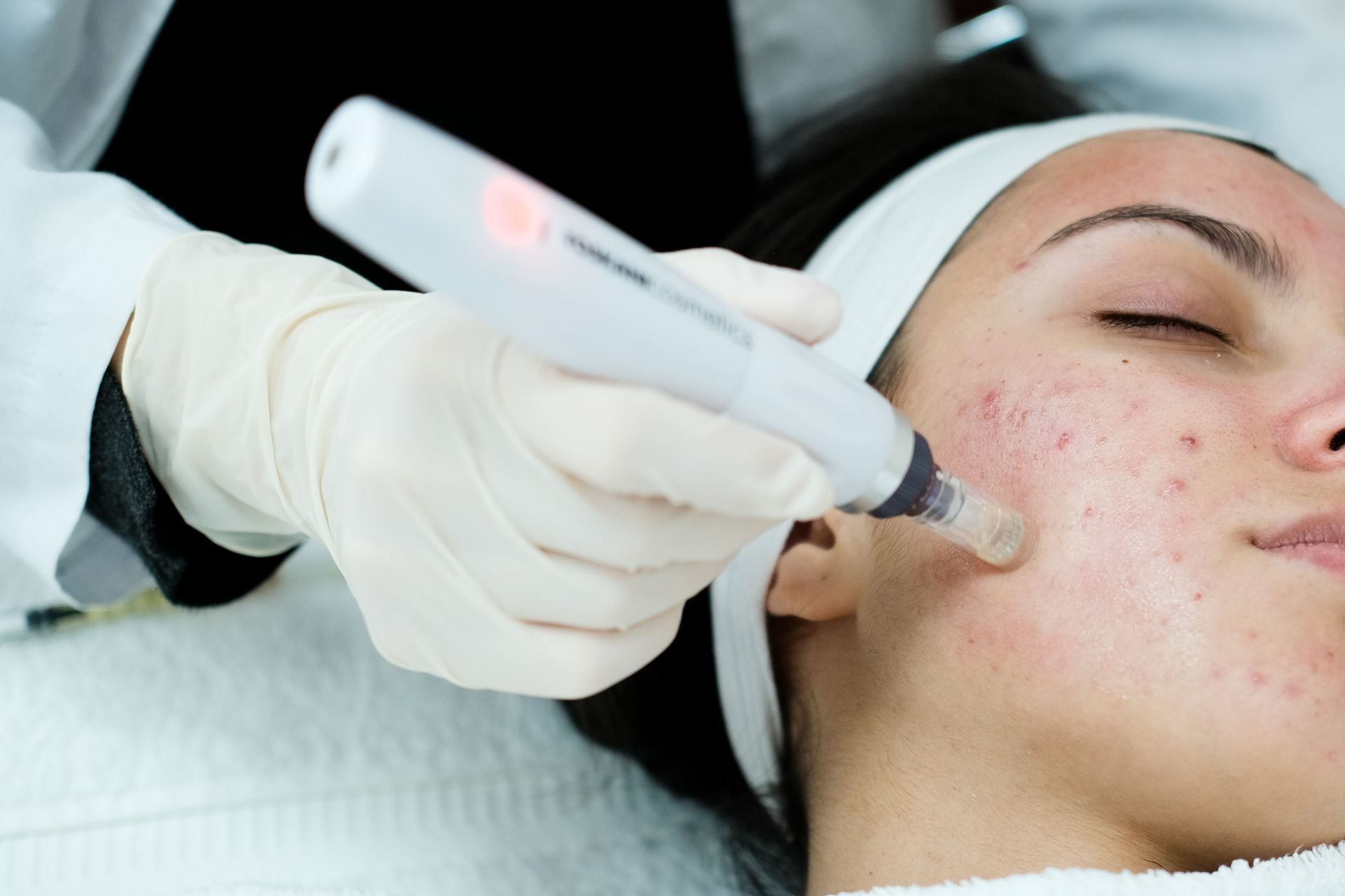A woman is getting a treatment on her face with a machine.