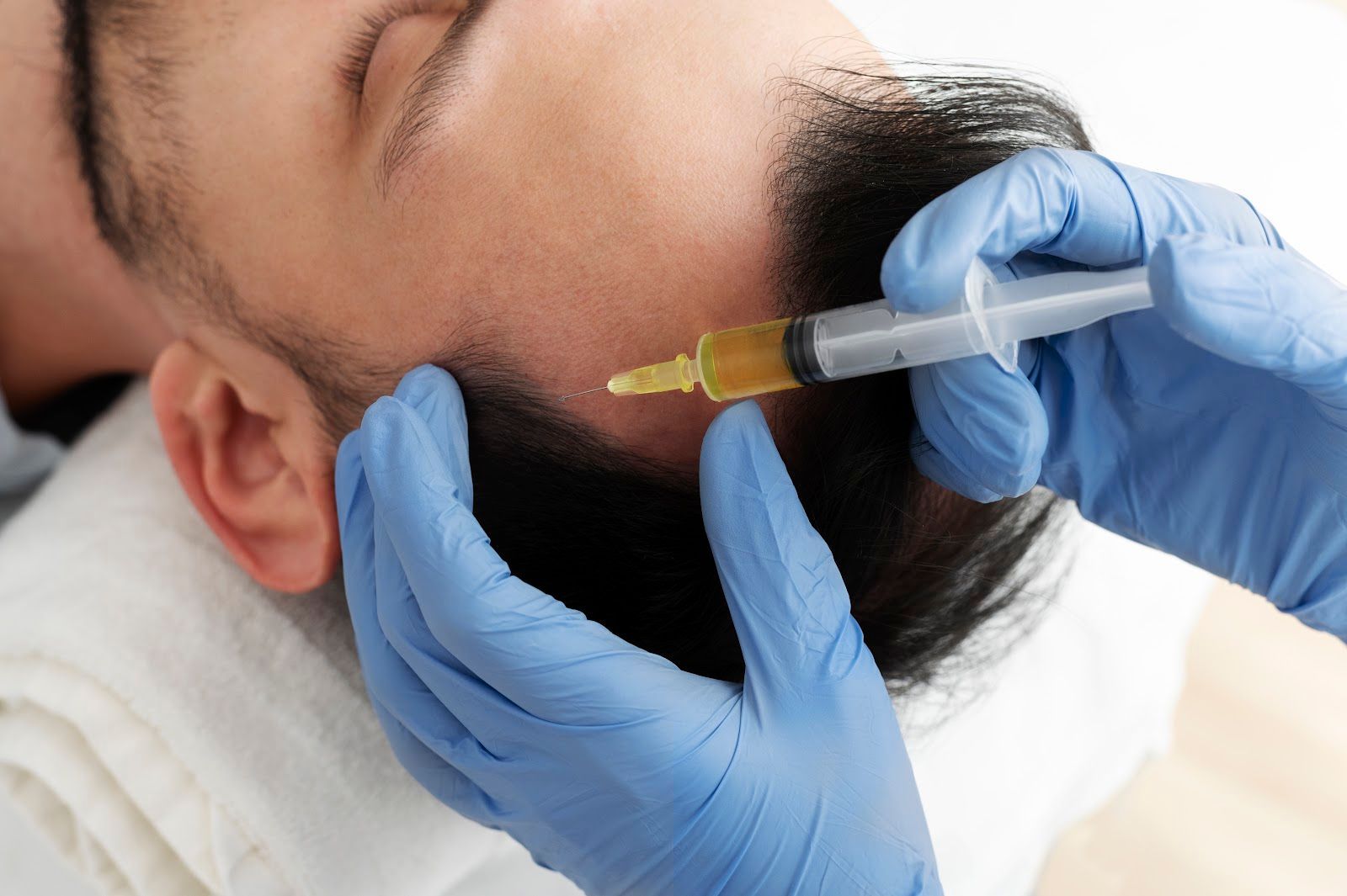 Person receiving a scalp injection with a syringe by a person wearing blue gloves.