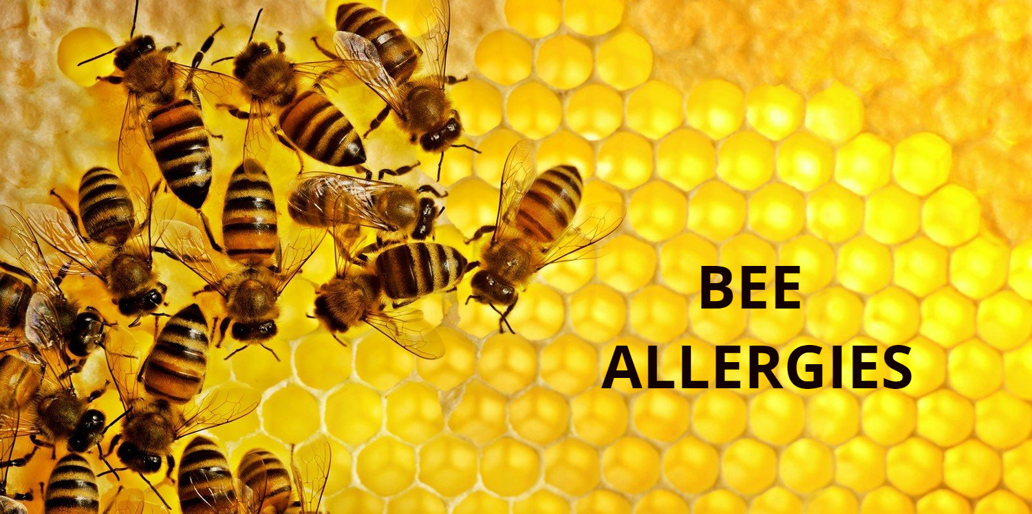 Bee allergy, image