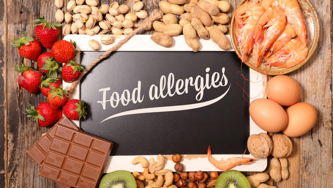 Food allergy, image