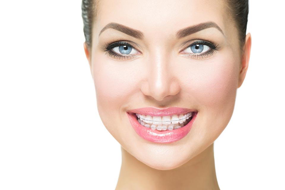 Frau mit Zahnspange lächelt und zeigt dabei ihre Zähne