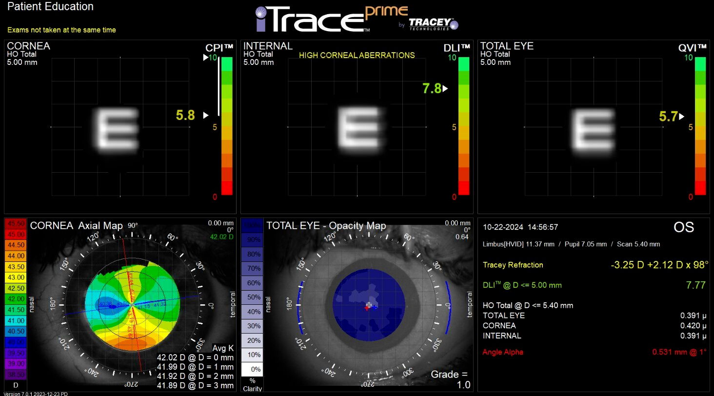 Medical eye scan dashboard with three grayscale eye images, color heatmaps, and iTrace analysis metrics