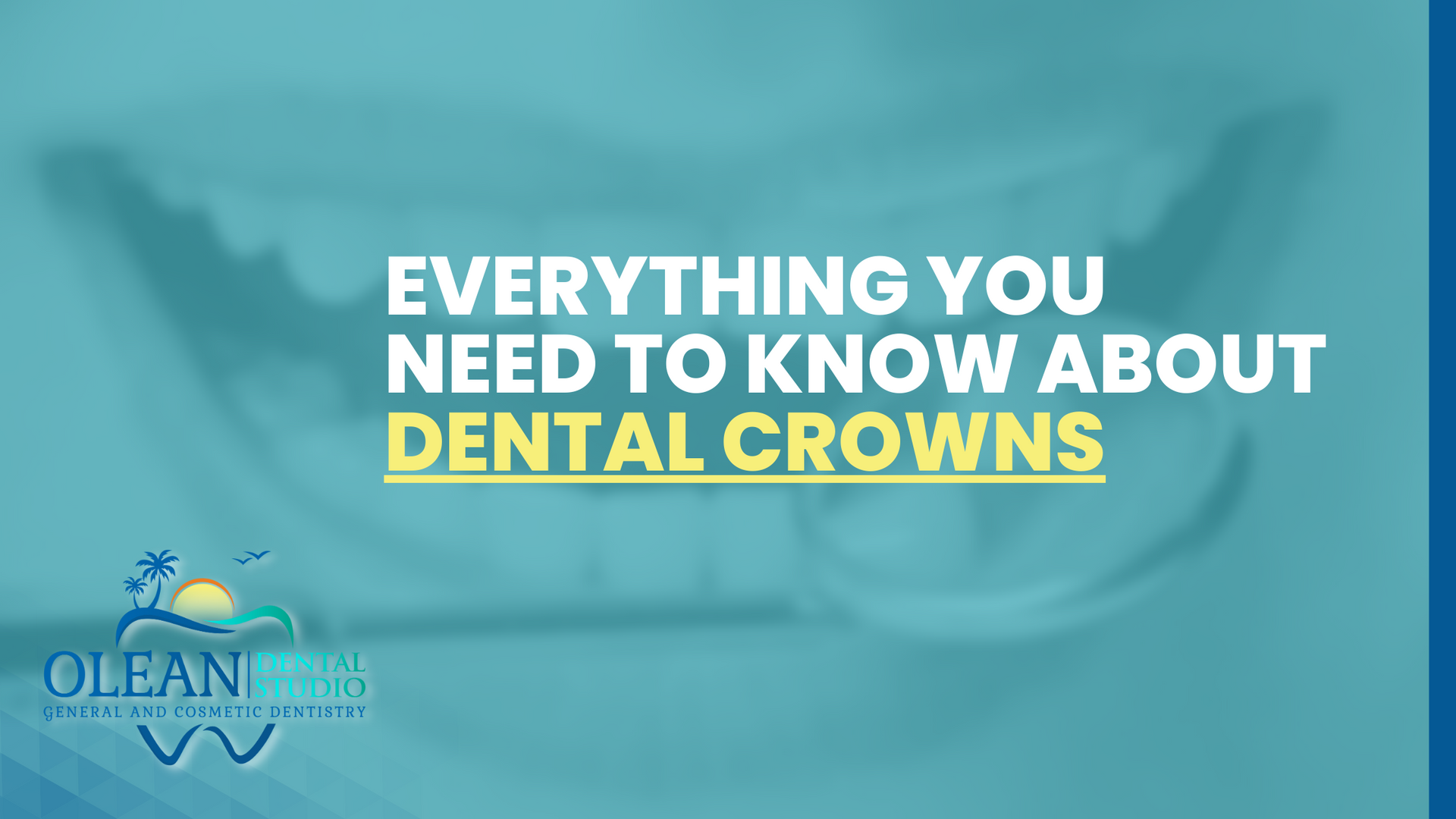 Everything You Need to Know About Dental Crowns