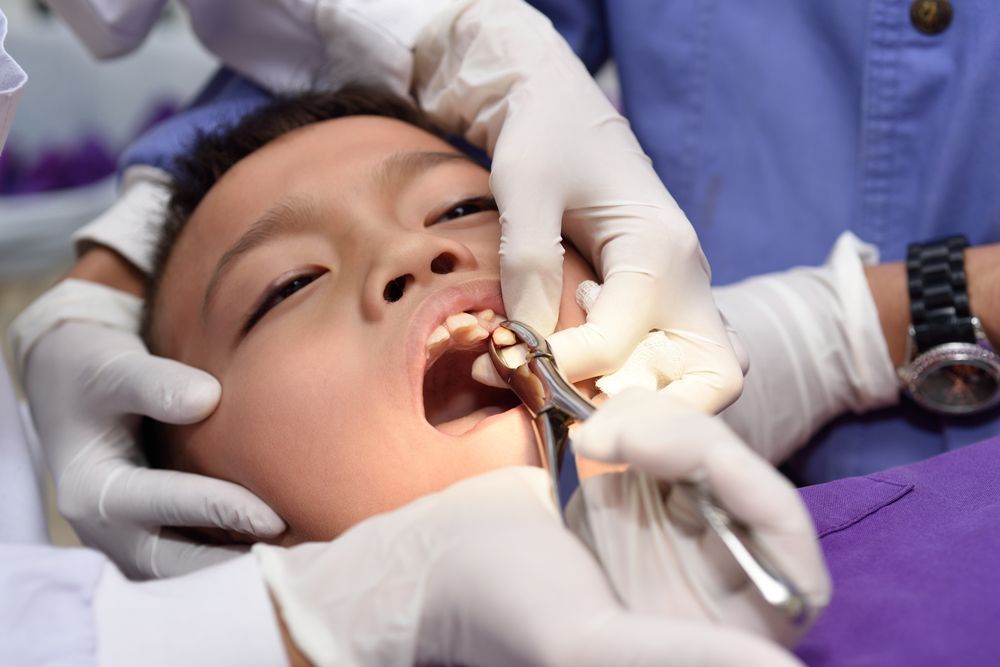 Child having a tooth extracted at a dentist's office; instruments in mouth.