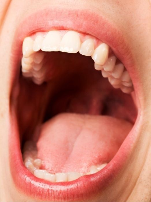 Open human mouth, showing teeth and tongue.