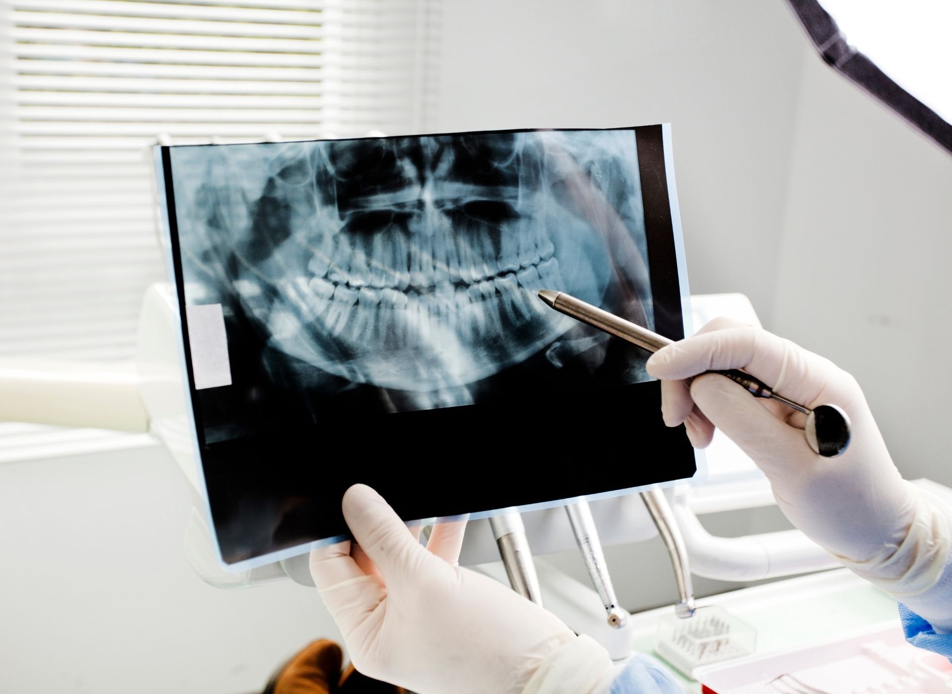 Dentist using a 3D scanner on a patient's open mouth in a dental office.
