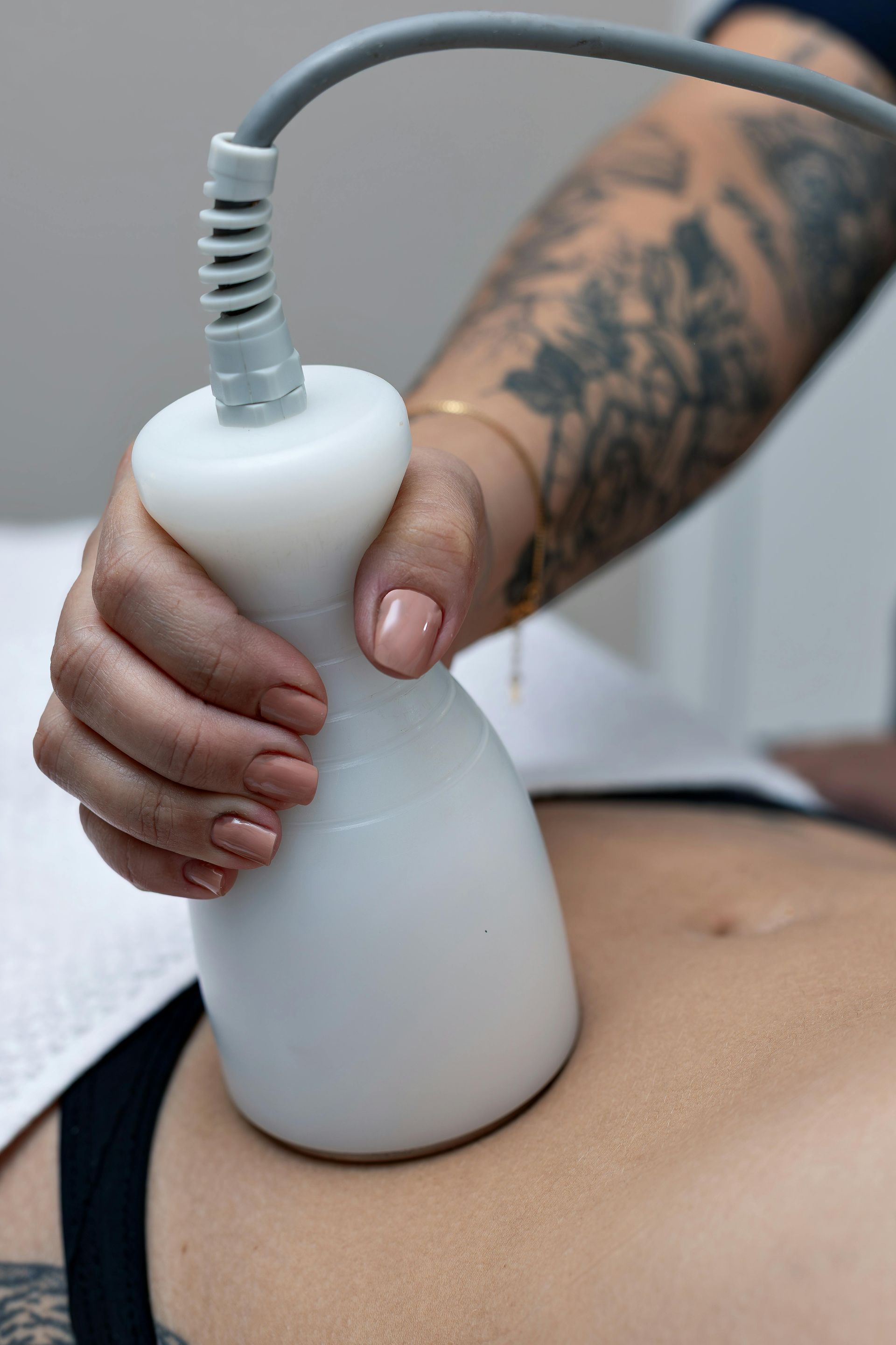 Person receiving cosmetic treatment on their abdomen; white device held by tattooed arm.