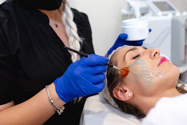 Chemical Peels — Indianapolis, IN — Cheek 2 Chic SkinCare Studio