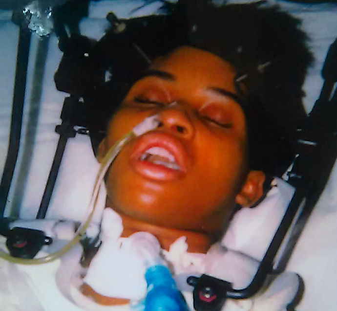 Person in medical bed, appearing unconscious, with medical tubes and equipment.