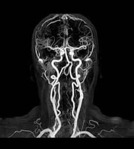 RADIOLOGÍA E IMAGEN