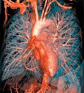 RADIOLOGÍA E IMAGEN