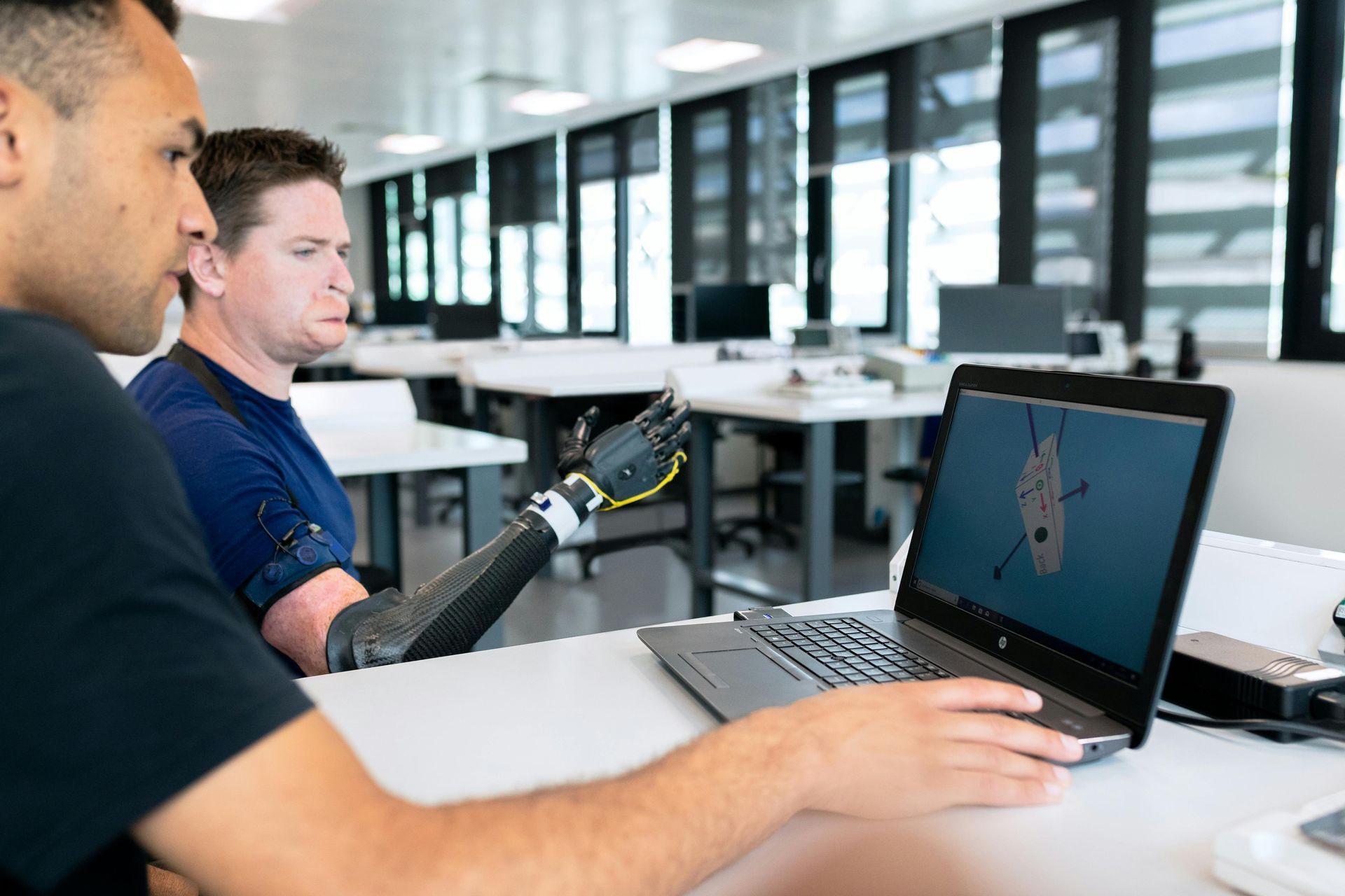 A man with a prosthetic arm is using a laptop computer.