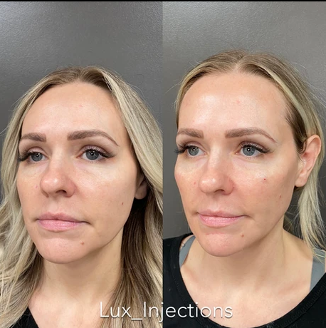 A before and after photo of a woman 's face.