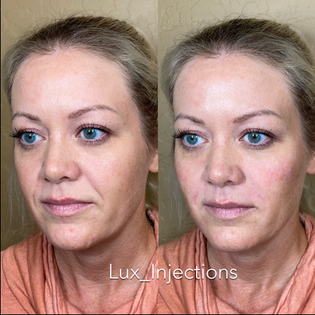 A before and after photo of a woman 's face.