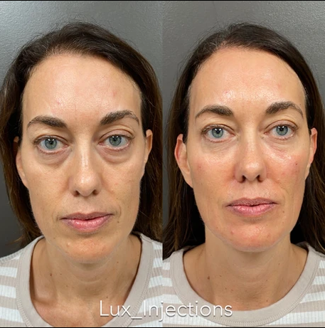 A before and after photo of a woman 's face.