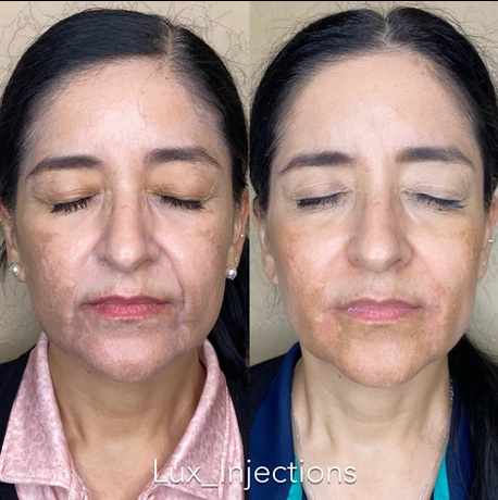 A before and after photo of a woman 's face with her eyes closed.