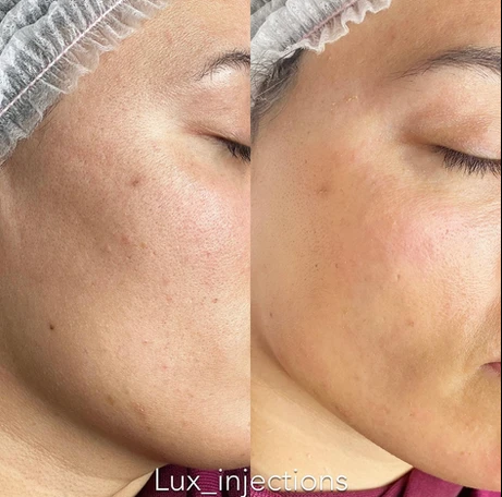 A before and after photo of a woman 's face.