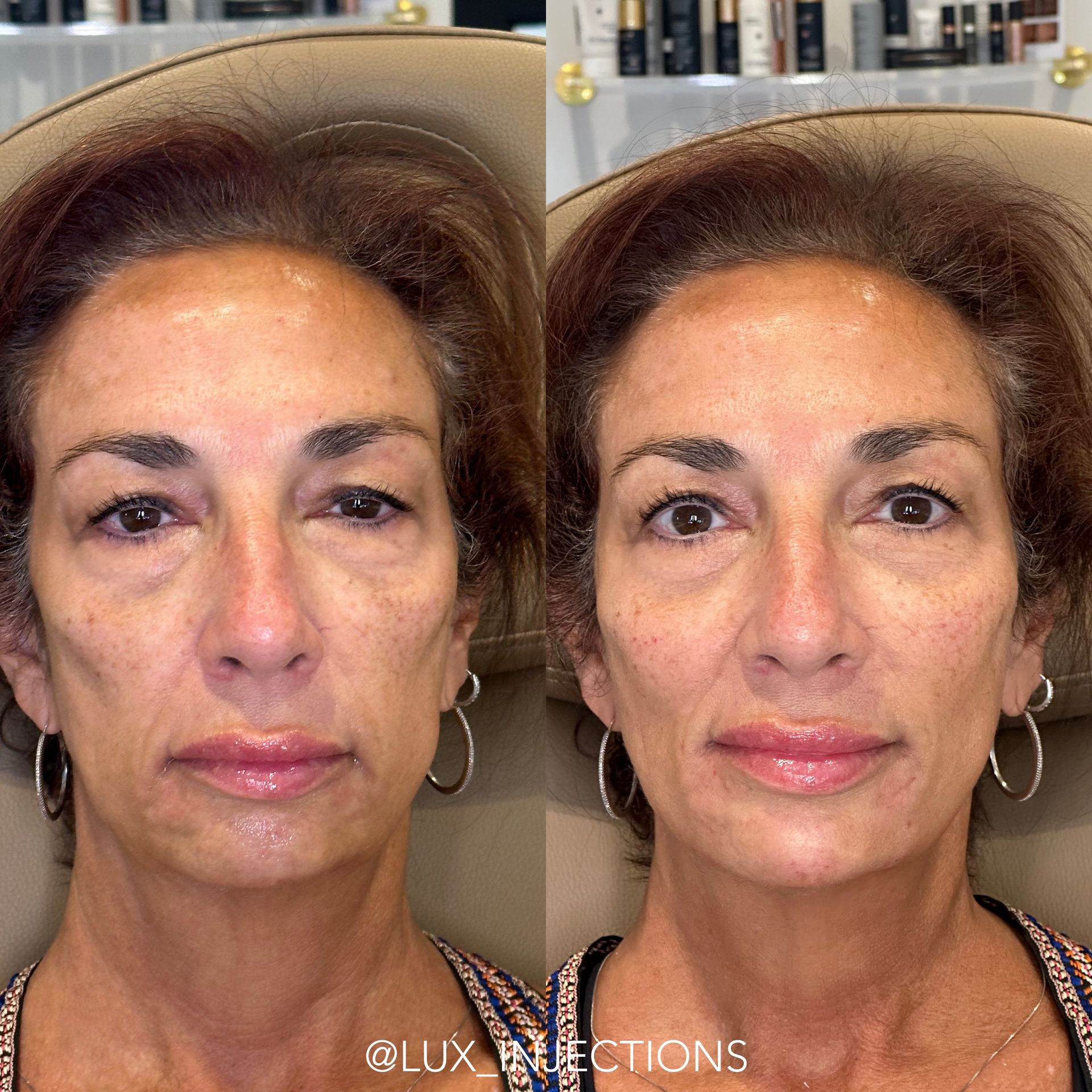 A before and after photo of a woman 's face.