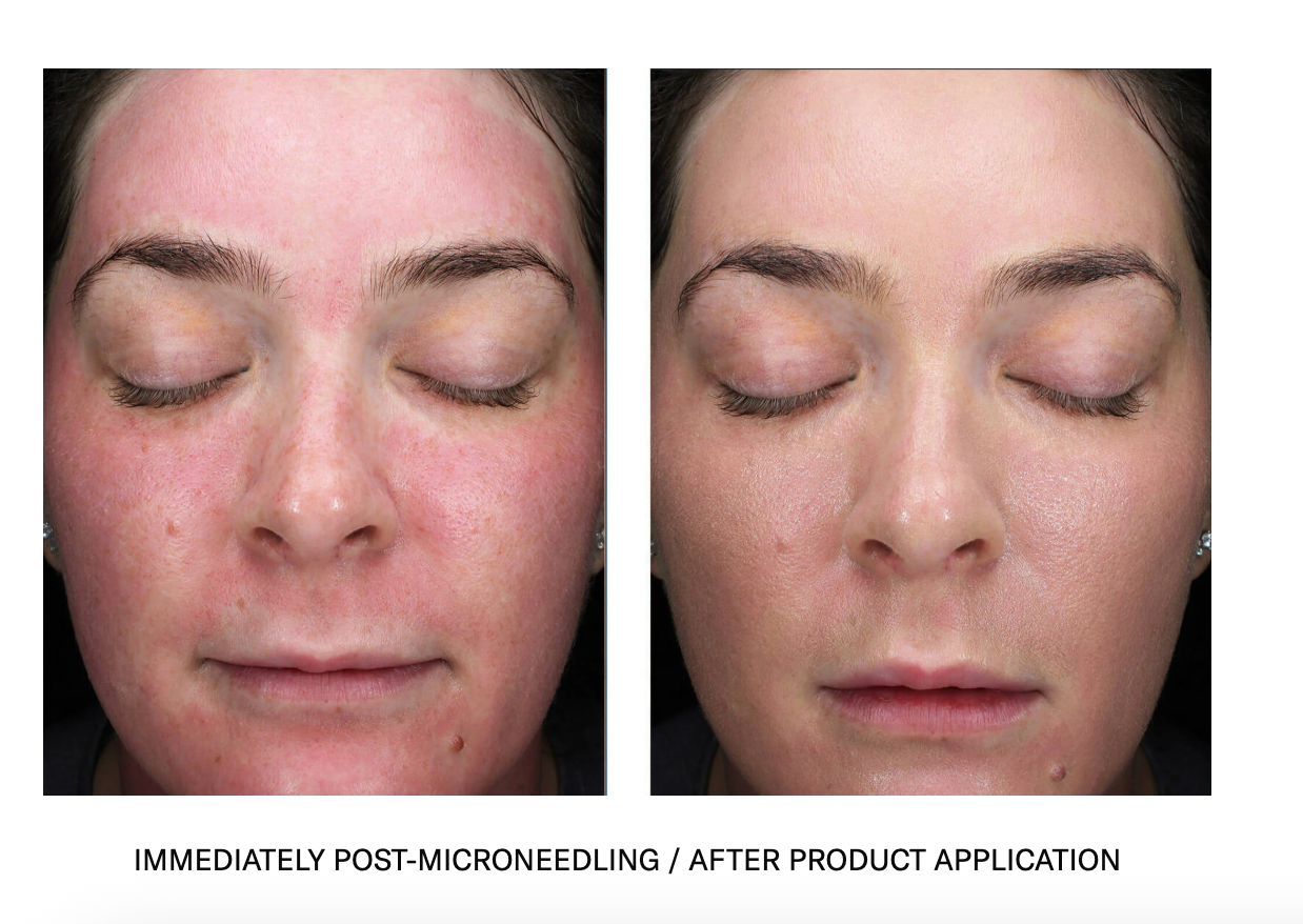 A before and after photo of a woman 's face with her eyes closed.