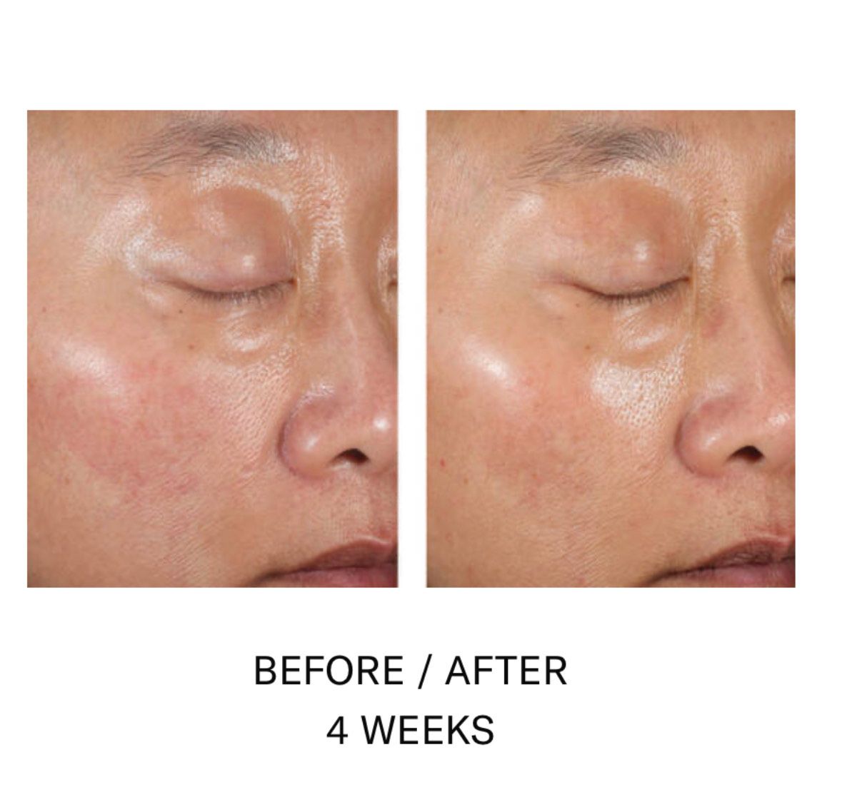 A before and after photo of a man 's face