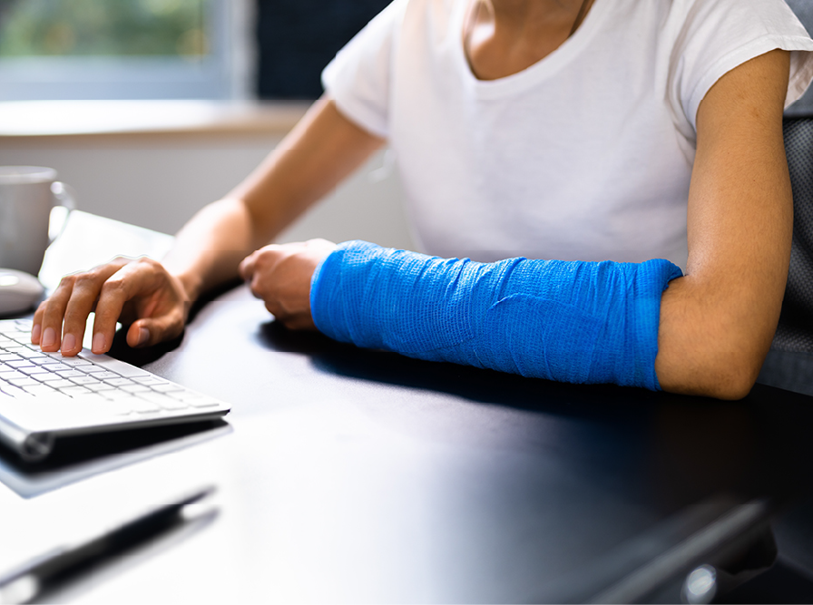 Person with a blue cast on their left arm working at a desk, typing with right hand.