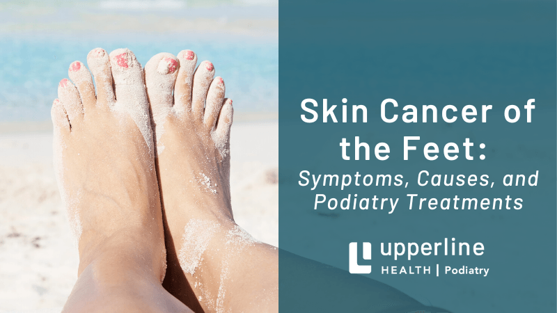 skin cancer of the feet