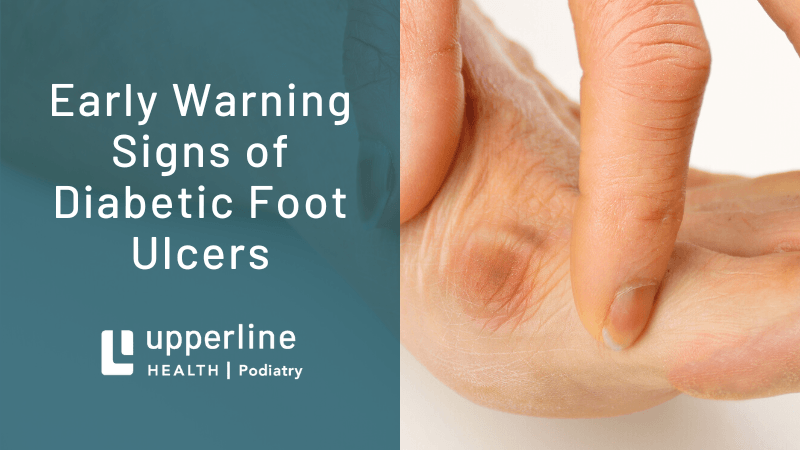diabetic foot ulcers