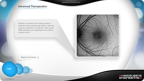 Ocular fundus image with a text box describing advanced therapeutics for eye diseases.