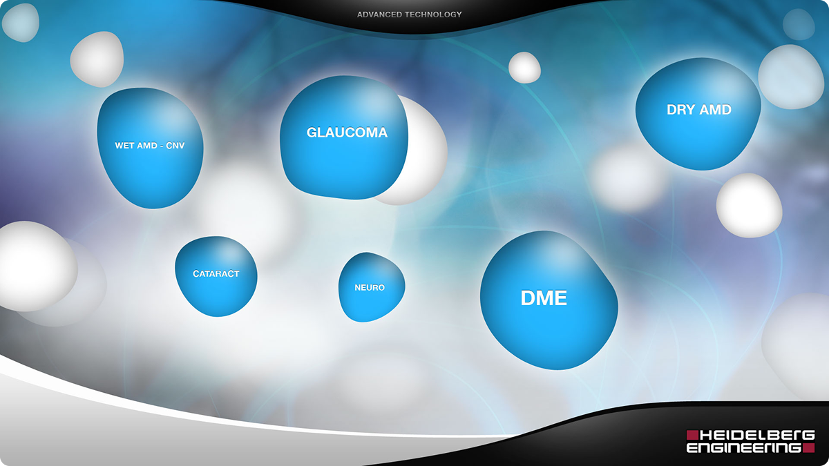 Blue bubbles with text floating against a blurred background. Titles include Cataract, Glaucoma, Dry AMD, and others.