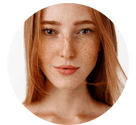 Microneedling Heals Sun Damaged Skin