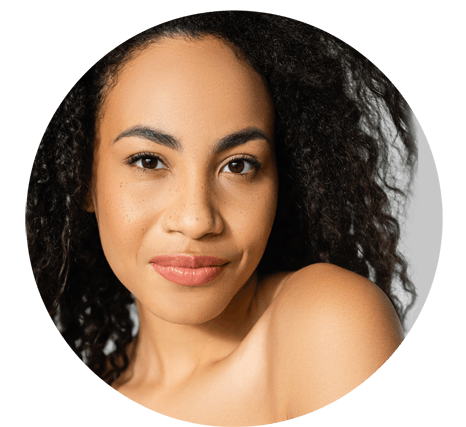 Microneedling Heals Acne Scars