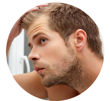 Microneedling Stimulates Hair Growth